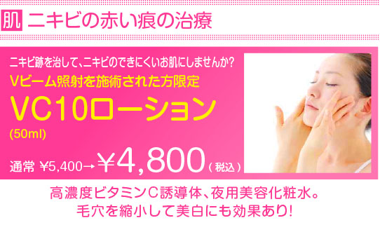 愛知県名古屋市天白区塩釜口にあるしおがま皮ふ科クリニックの2015年5月のキャンペーン、VC10ローション