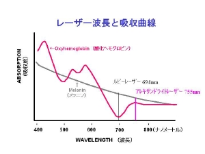 脱毛の説明画像